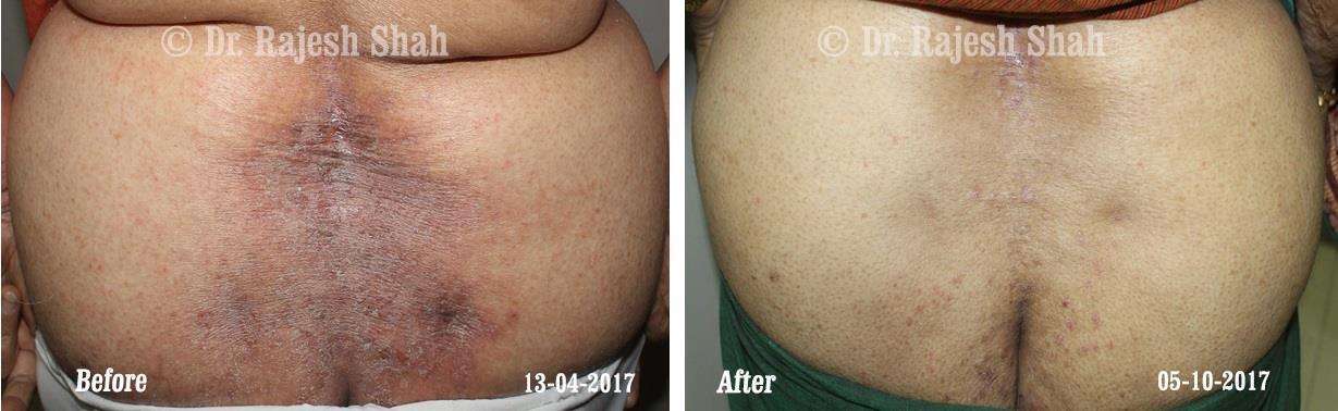 lifeforce homeopathy case-photos